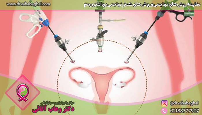روش های تهاجمی و کمتر تهاجمی عمل برداشتن رحم