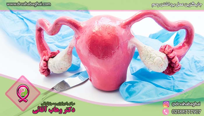 جایگزین عمل برداشتن رحم