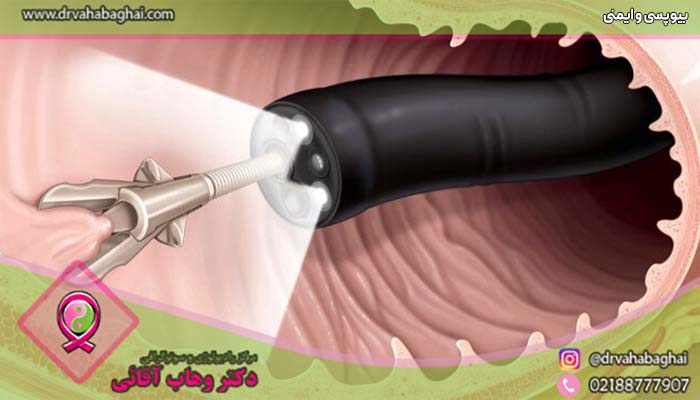 بیوپسی و ایمنی