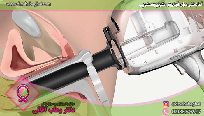 آمادگی برای انجام کولپوسکوپی