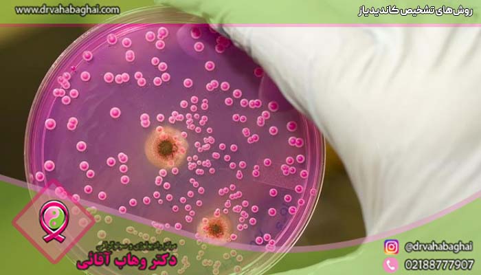 روش های تشخیص بیماری کاندیدیاز