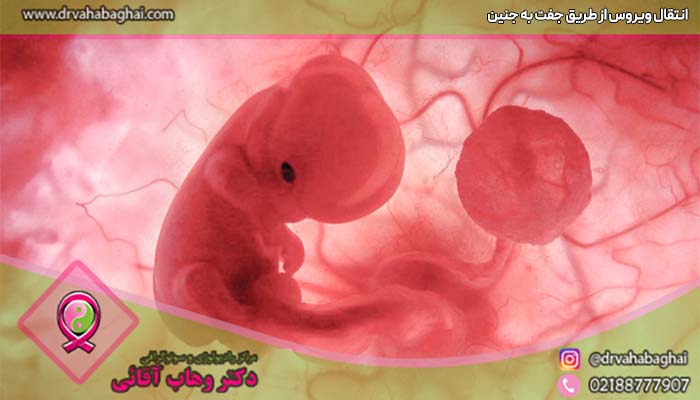 انتقال کرونا از راه جفت به جنین