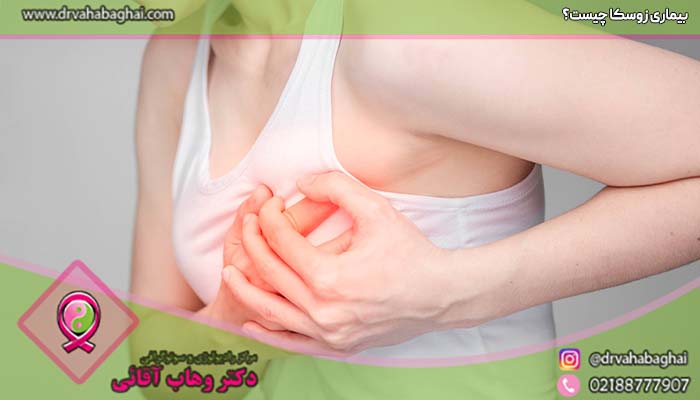 بیماری زوسکا چیست