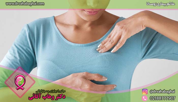 علائم بیماری زوسکا