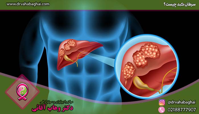 سرطان کبد چیست