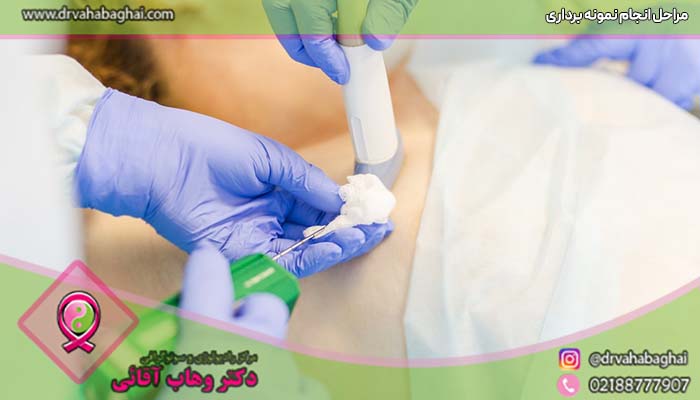 مراحل انجام بیوپسی پستان