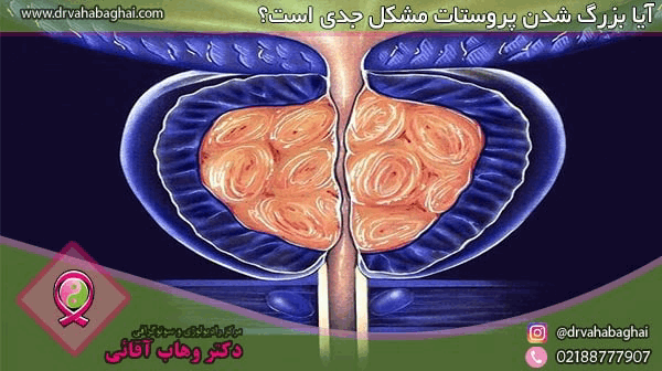 آیا بزرگ شدن پروستات مشکل جدی است؟