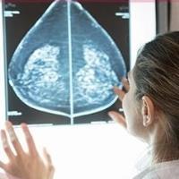 خواندن جواب آزمایش ماموگرافی