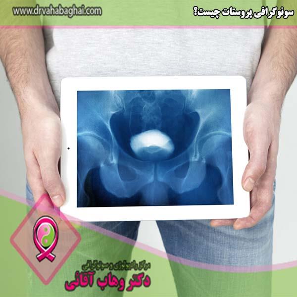 سونوگرافی پروستات چیست؟