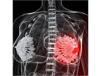 بیماری زوسکا