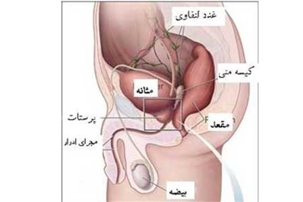 پروستات چیست؟