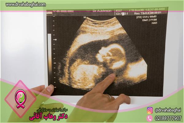 تفسیر سونوگرافی بارداری و جنین + اصطلاحات رایج