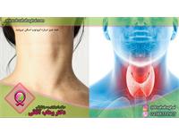 اسکن تیروئید