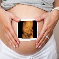 سونوگرافی سه بعدی