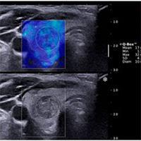 الاستوگرافی