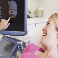 سونوگرافی سه بعدی