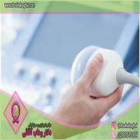 سونوگرافی بیضه ها