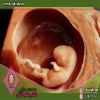 سونوگرافی سه بعدی از رحم