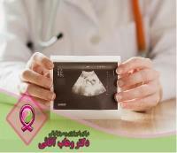 سونوگرافی چیست