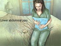 بیماری آندومتریوز در زنان