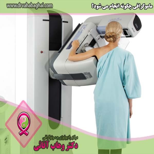 ماموگرافی چگونه انجام می‌شود؟