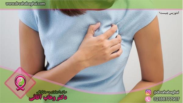 آدنوزیس (Adenosis) چیست؟/ علائم و درمان آن