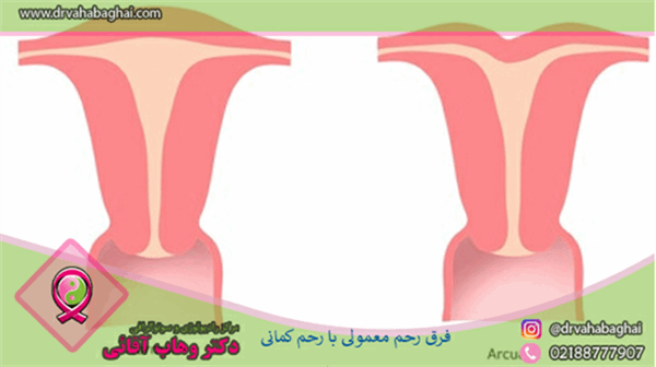 انواع و چگونگی ایجاد اختلالات رحمی