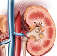 کلیه و مثانه