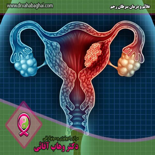 سرطان رحم چه علائمی دارد و درمان آن